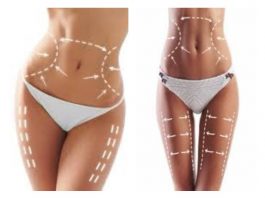 cuanto cuesta la liposuccion por zona corporal