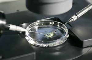 imagen del procedimiento de fecundación in vitro o FIV