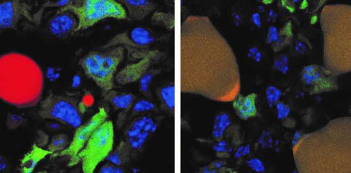 imágen de la conversión de células de cáncer en grasa
