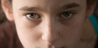 doctores especialistas en rinoplastias
