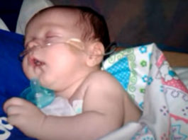fisioterapia respiratoria infantil