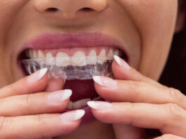 ortodoncia invisible corrige problemas dentales