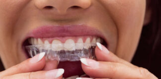 ortodoncia invisible corrige problemas dentales