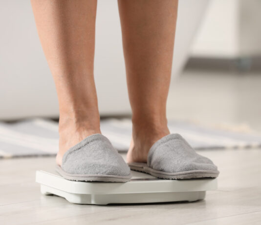 lipedema en mujeres sin diagnostico